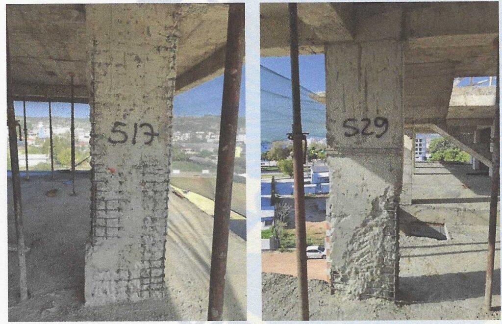 derin-segregasyon-kolon-donati-acikta-2