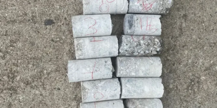 Karot Sonucu Ne Zaman Çıkar? Süreler, Aşamalar ve Sonuç Olumsuz Çıkarsa Yapılacaklar